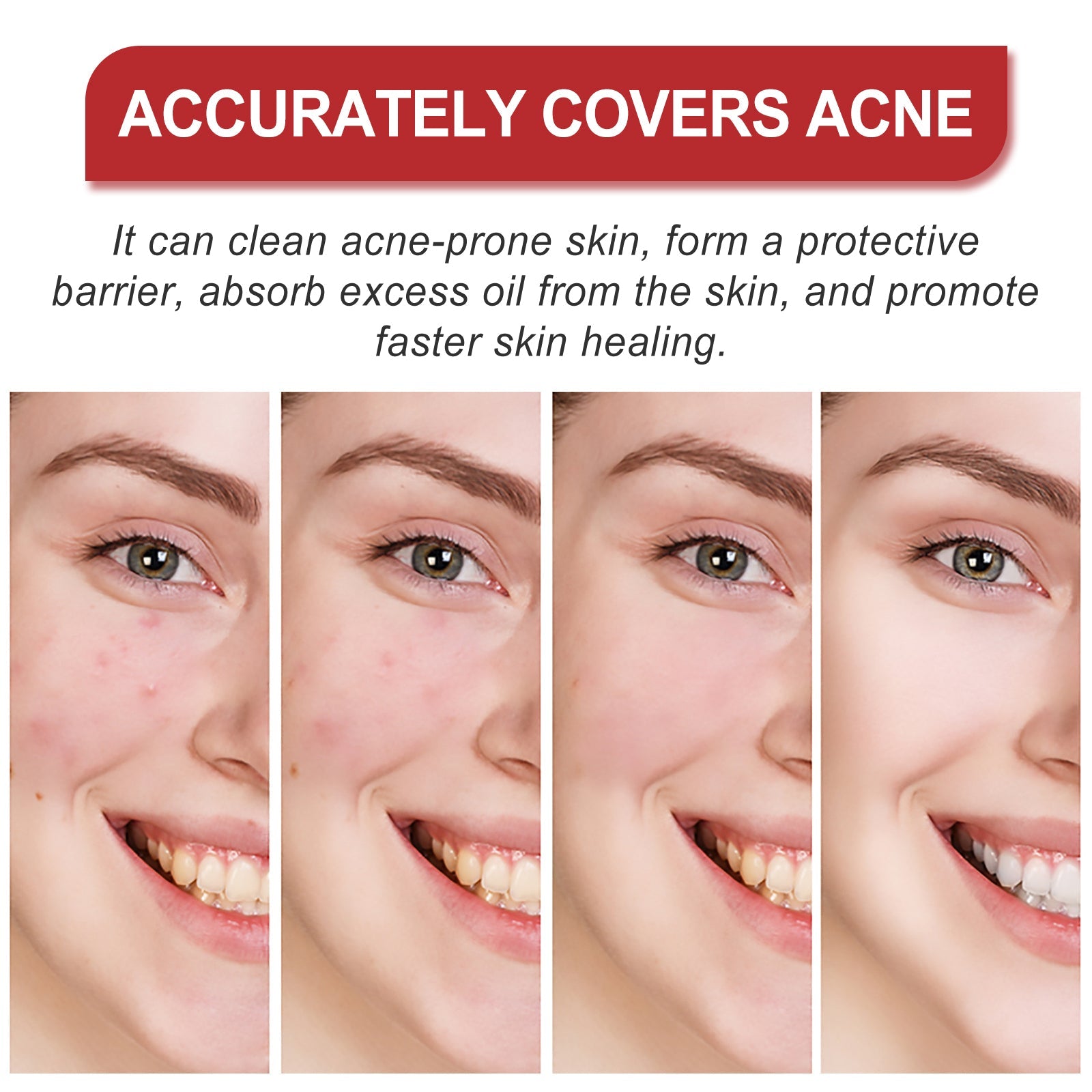 Facial Care Acne Patch, Gently Clean And Reduce Acne Skin Soft Smooth Multi-Shape Portable Acne Patch