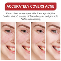 Facial Care Acne Patch, Gently Clean And Reduce Acne Skin Soft Smooth Multi-Shape Portable Acne Patch