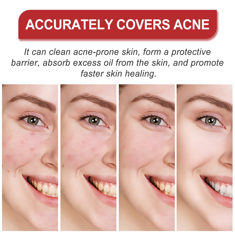 Facial Care Acne Patch, Gently Clean And Reduce Acne Skin Soft Smooth Multi-Shape Portable Acne Patch