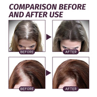 Volumizing And Dense Hair Spray, Repair Dry Hair, Strengthen Hair Nourishing And Volumizing Hair Treatment Spray