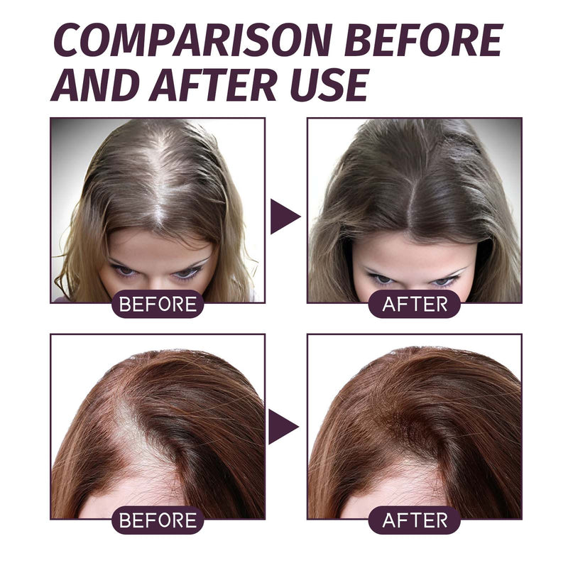 Volumizing And Dense Hair Spray, Repair Dry Hair, Strengthen Hair Nourishing And Volumizing Hair Treatment Spray
