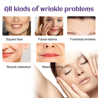 EELHOE Facial Wrinkle Patch, Droop Decree Line Lift Facial Skin Tightens Mouth Line Cheek Patch