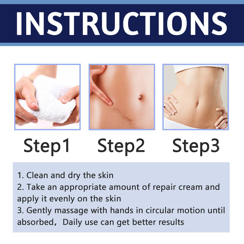Scar Repair Cream Lighten Scar Pregnancy Surgery Scar Repair Skin Smooth Skin Care Cream