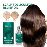 Scalp Serum, Deep Cleansing Follicle Dandruff Repair Hair Smoothing Treatment Essence