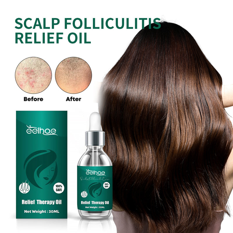 Scalp Serum, Deep Cleansing Follicle Dandruff Repair Hair Smoothing Treatment Essence