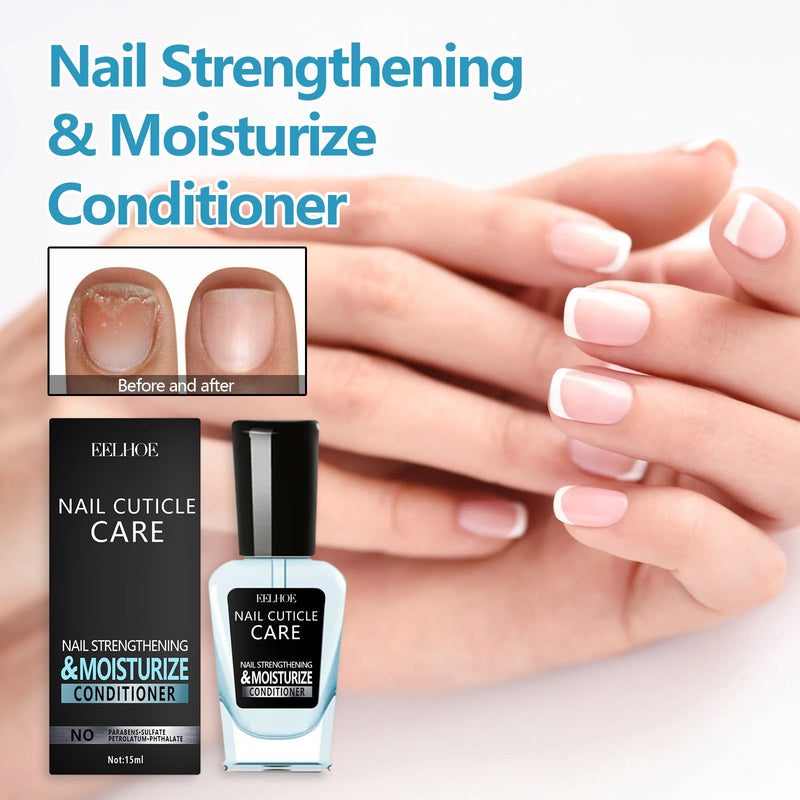Nail Repair Solution, Repair Hands And Feet Gray Nails Rote Nails Thickening Toenails Clean And Bright Nail Care Solution