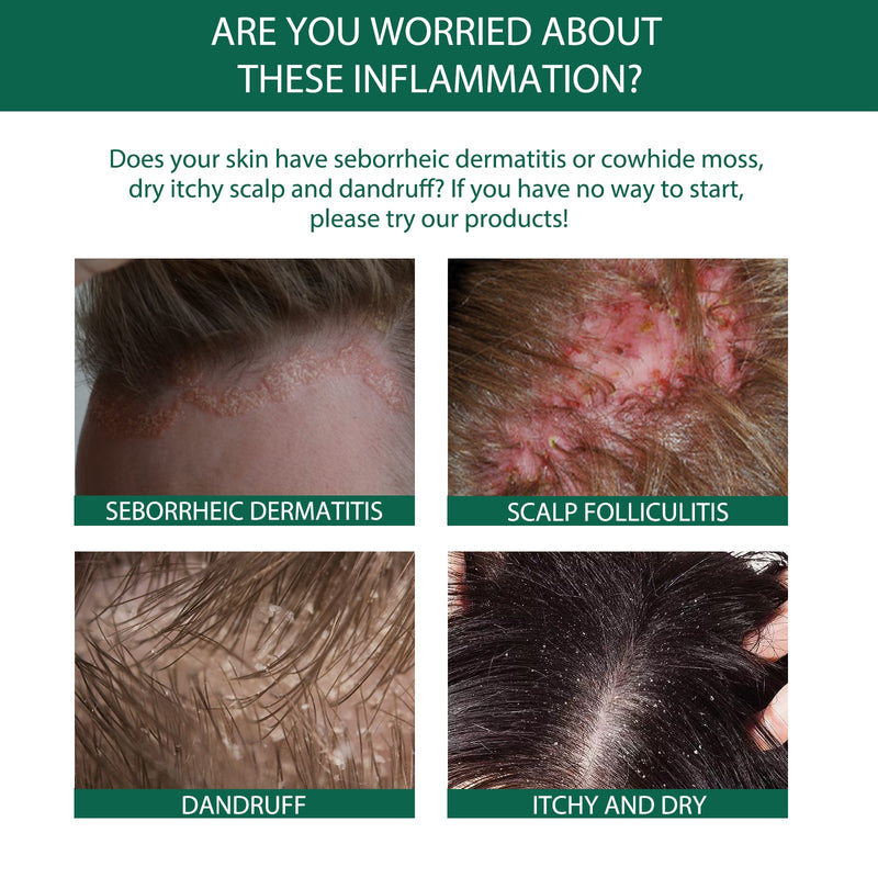 Scalp Serum, Deep Cleansing Follicle Dandruff Repair Hair Smoothing Treatment Essence