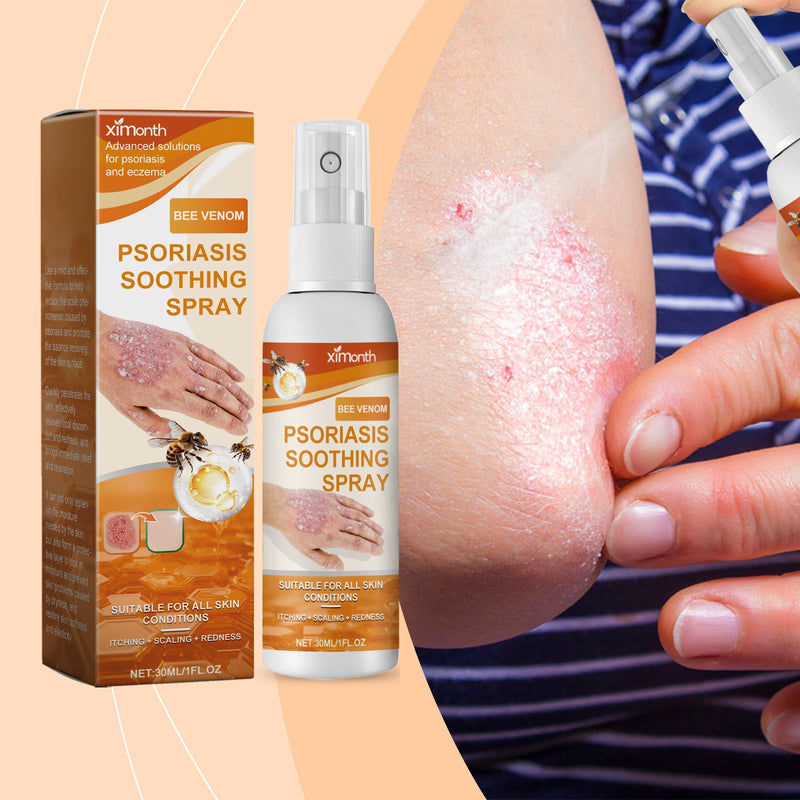 Moss Care Spray Repair Skin Moss Moisturizing Skin Anti-Itch Treatment Topical Spray