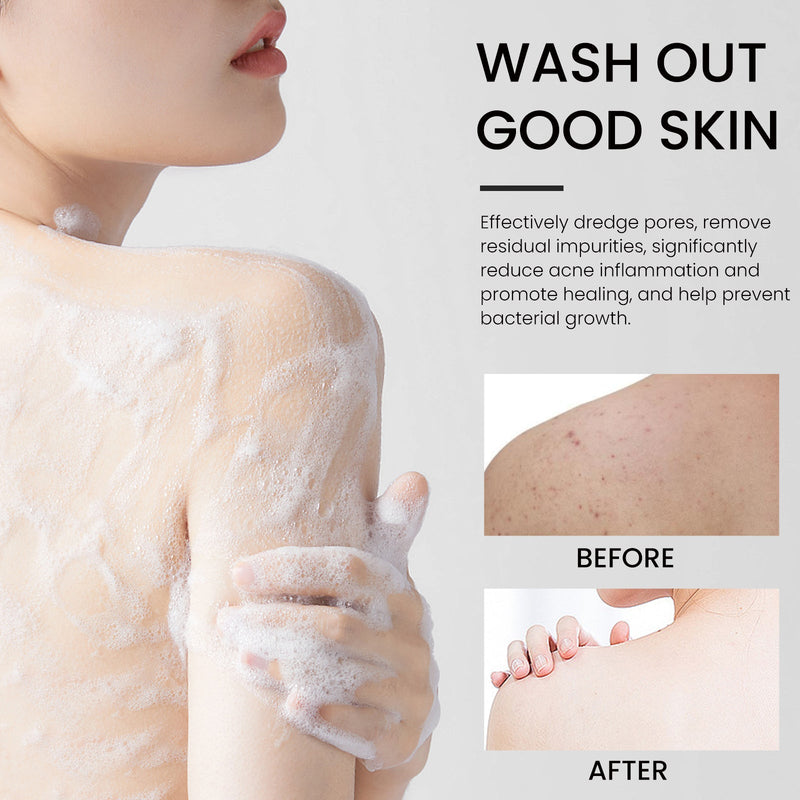 Carbon Clay Back Soap Whitening Body Cleansing Skin Lightening Dark Spots Acne Mark Exfoliating Moisturizing Brightening Soap