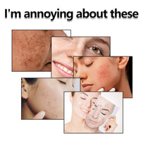 Gentle Exfoliating Toner, Repair Skin Barrier Facial Redness Hydrating Shine Refreshing Toner