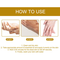 Acanthosis Nigricans Removal Oil, Exfoliating Light Black Brightening And Beauty Skin Oil