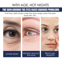 EELHOE Eye Repair Essence Moisturizes, Hydrates And Lightened Eye Lines, Strengthens, Lifts And Smooths Fine Lines