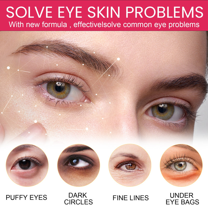 Eye Cream, Reduce Pouch Black Rim Of The Eye Brighten The Skin Moisturizing Eye Anti Aging
