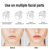 EELHOE Facial Lifting Patch, Lift Face Double Chin V Face Melon Seed Face Invisible Lifting Patch