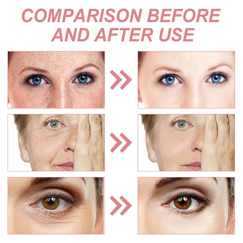 5 In 1 Firming Cream, Reduces Wrinkles And Spots, Improves Dullness And Hydrates Moisturizing Lift Cream