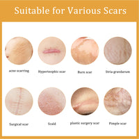 EELHOE Desalting Skin Scar Cream, Skin Burn Scalding Surgical Scar Wound Repair Cream