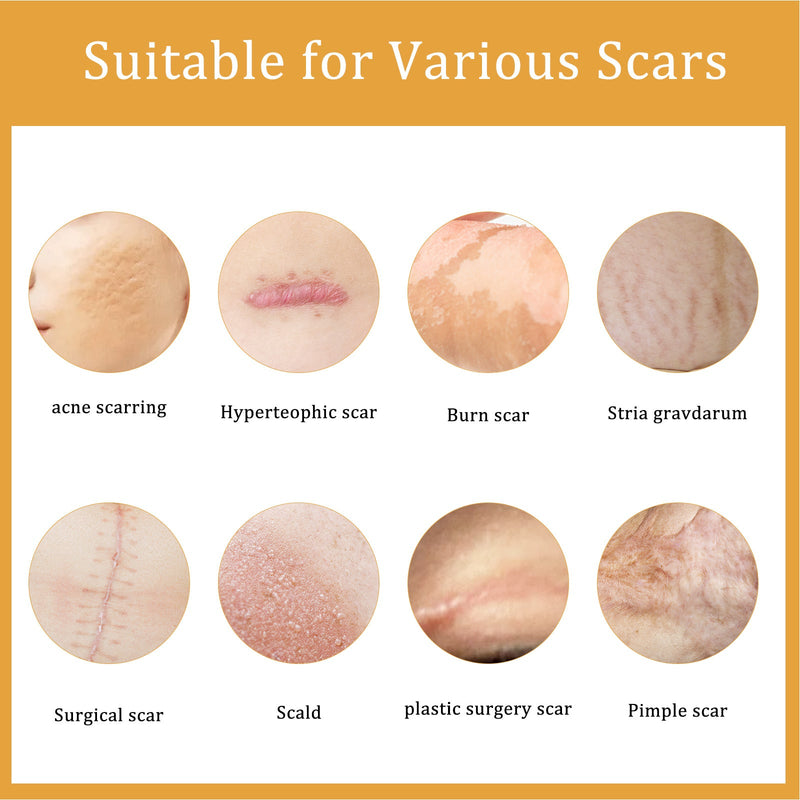 EELHOE Desalting Skin Scar Cream, Skin Burn Scalding Surgical Scar Wound Repair Cream
