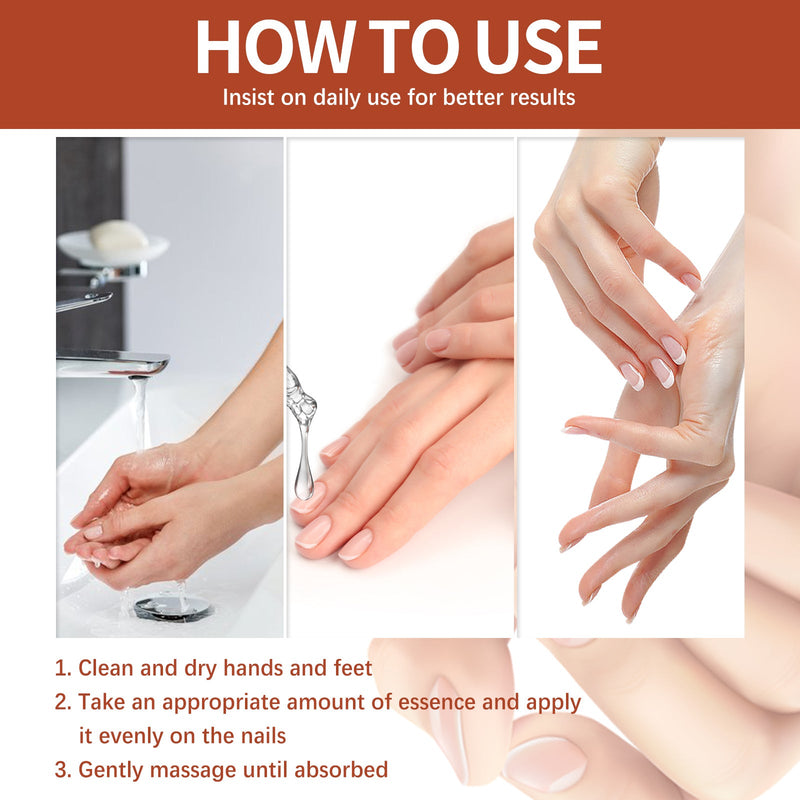 Nail Care Essence Hand And Foot Gray Nail Repair Soft Nail Thickening Moisturizing Nail Care Essence