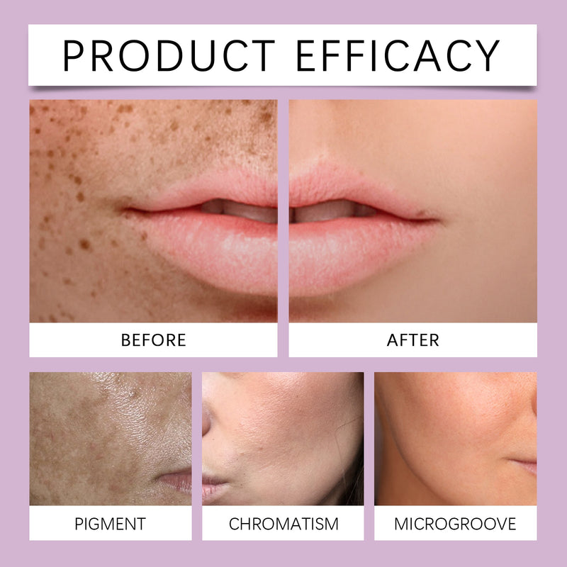 Tone Balancing Essence, Desalination Moisturizing Facial Spots Moist Shine Bright Skin Essence