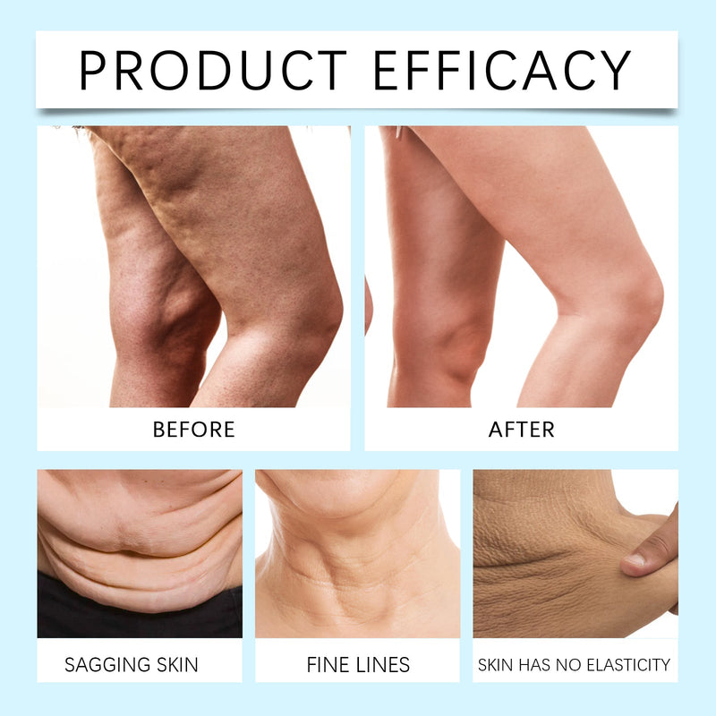 OUHOE Anti-Wrinkle Firming Multi-Purpose Cream, Body Buttocks Chest Legs Skin Moisturizing Massage Firming Cream