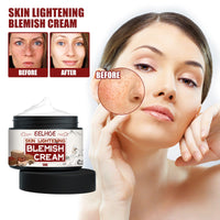 Brightening Cream For Blemish Reduction, Brightening Skin, Moisturizing Beauty And Lightening Face Cream For Yellow Spots