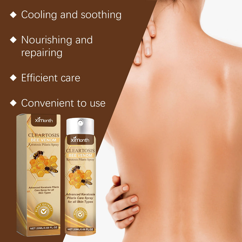 Ximonth Hair Keratosis Treatment Spray Cleans Back Acne And Moisturizes Smooth Body Skin Spray