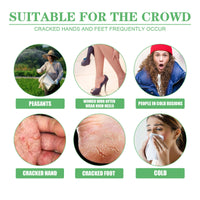 Dry Crack Protection Moisturizing Cream, Moisturizing And Hydrating Hand And Foot Repair Skin Care Cream