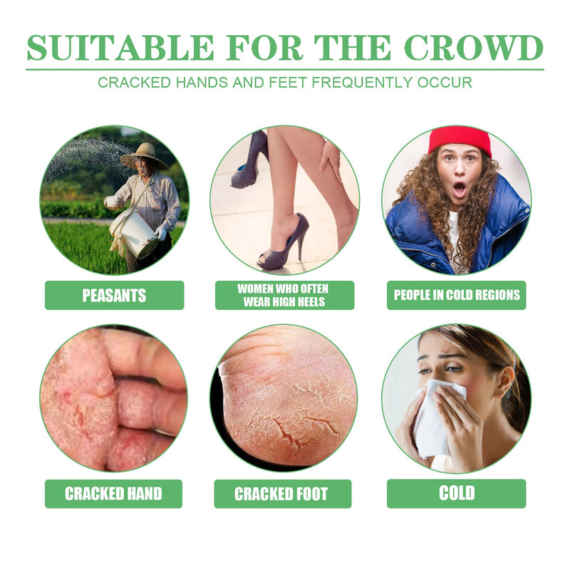 Dry Crack Protection Moisturizing Cream, Moisturizing And Hydrating Hand And Foot Repair Skin Care Cream