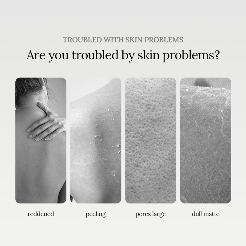 EELHOE Niacinamide Body Wash - Cleanses & Repairs, Delicate Pore Care