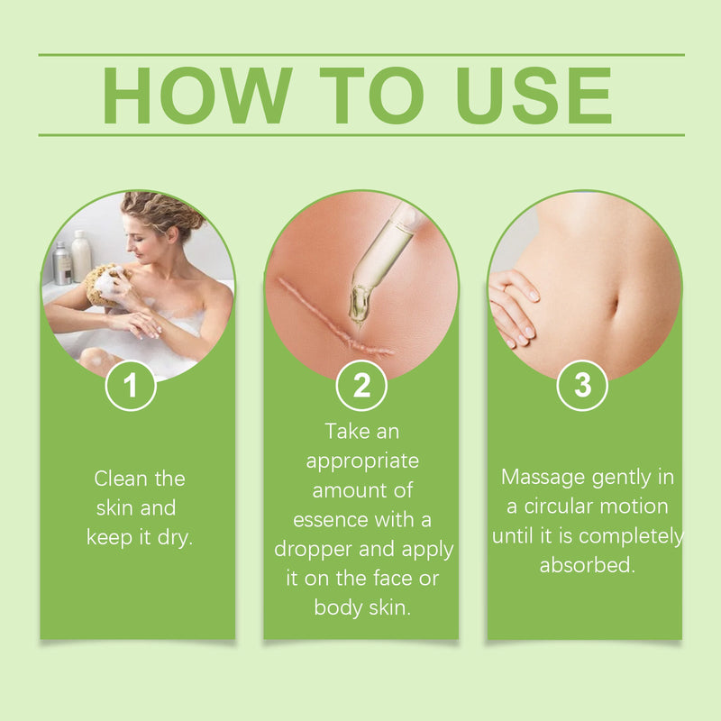 Skin Scar Care Essence, Lighten Postpartum Scars, Smooth Skin And Moisturize Body Care Essence