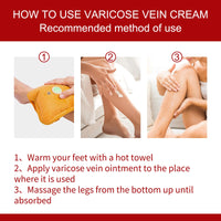 South Moon Varicose Veins Cream, Leg Massage Treatment Soreness Relief Repair Varicose Body Care Cream