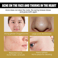 Advanced Snail 92 All In One Cream, Brightening And Firming Skin Face Cream With Moisturizing Moisturizing Moisture
