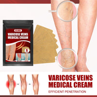 Aricose Veins Medical Cream, Relieve Leg Swelling Earthworm Leg Vein Massage To Relieve Pain