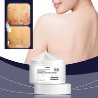 Skin Soothing Cream Gentle Soothing Skin Repair Nourishes Itchy And Swollen Skin Moisturizing And Soothing Cream