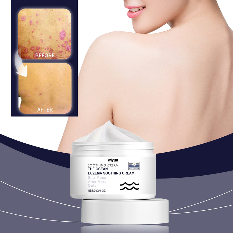Skin Soothing Cream Gentle Soothing Skin Repair Nourishes Itchy And Swollen Skin Moisturizing And Soothing Cream