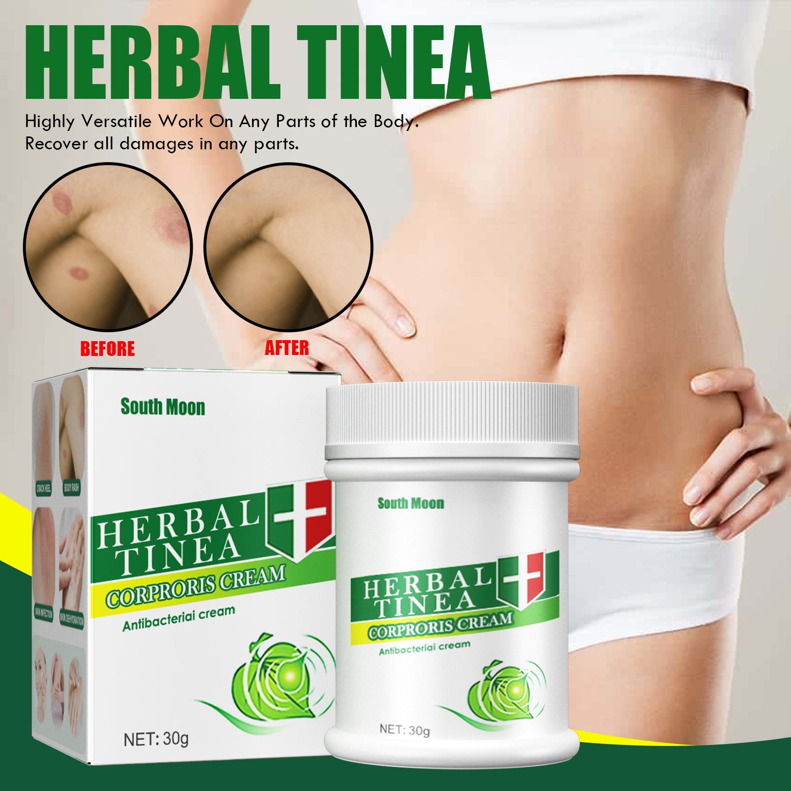 Herbal Tinea Corproris Cream, Mild Non-Irritating Ointment For Itch Relief External Ointment For The Body