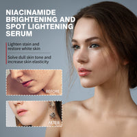 Nicotinamide Brightening And Spot Reducing Serum, Moisturizes Brightens Whiten Skin And Removes Dark Spots Serum