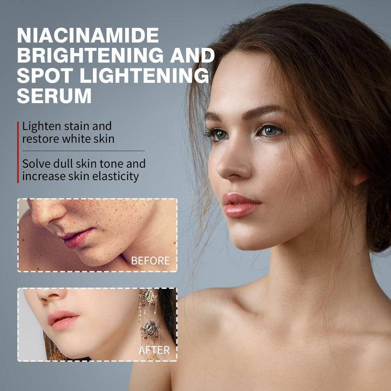 Nicotinamide Brightening And Spot Reducing Serum, Moisturizes Brightens Whiten Skin And Removes Dark Spots Serum