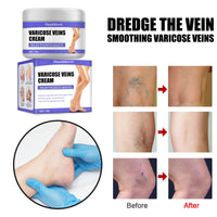 West&Month Leg Care Cream Gentle Care For Leg Discomfort Daily Moisturizing Maintenance Topical Massage Cream