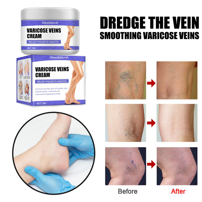 West&Month Leg Care Cream Gentle Care For Leg Discomfort Daily Moisturizing Maintenance Topical Massage Cream