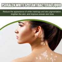 EELHOE White Spot Purifying Serum For Whitening And Repairing White Spot Spot And Perspiration Spot Skin Moisturizing Serum
