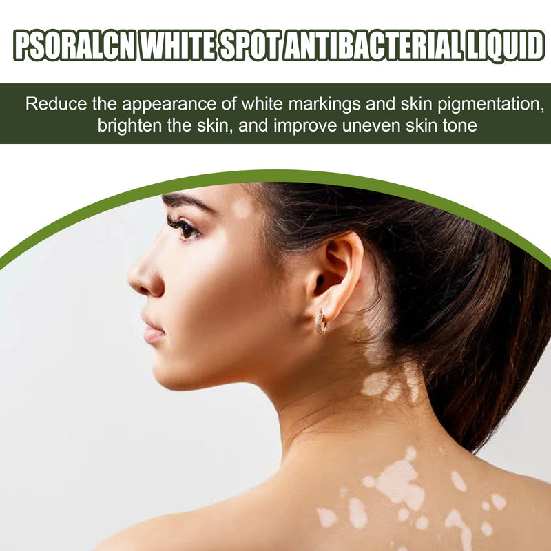 EELHOE White Spot Purifying Serum For Whitening And Repairing White Spot Spot And Perspiration Spot Skin Moisturizing Serum