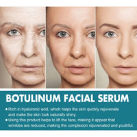 B5 Face Capsule Essence Reduces Fine Lines, Lifts Sagging, Firming And Moisturizing Face