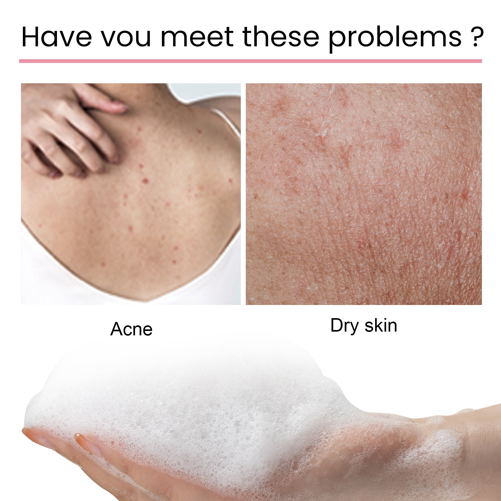 Carbon Clay Back Soap Whitening Body Cleansing Skin Lightening Dark Spots Acne Mark Exfoliating Moisturizing Brightening Soap
