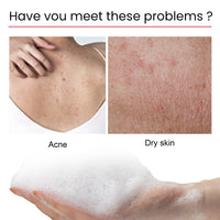 Carbon Clay Back Soap Whitening Body Cleansing Skin Lightening Dark Spots Acne Mark Exfoliating Moisturizing Brightening Soap