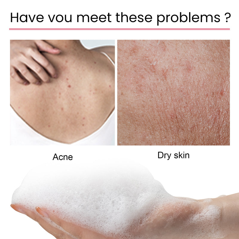 Carbon Clay Back Soap Whitening Body Cleansing Skin Lightening Dark Spots Acne Mark Exfoliating Moisturizing Brightening Soap