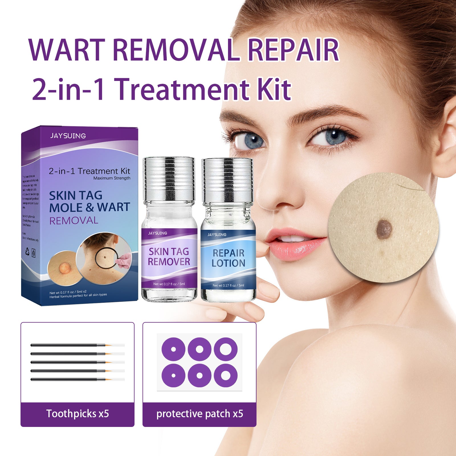 Wart Repair Kit, Skin Tag Remover Hand and Plantar Wart Mole Removal And Repair Lotion Set