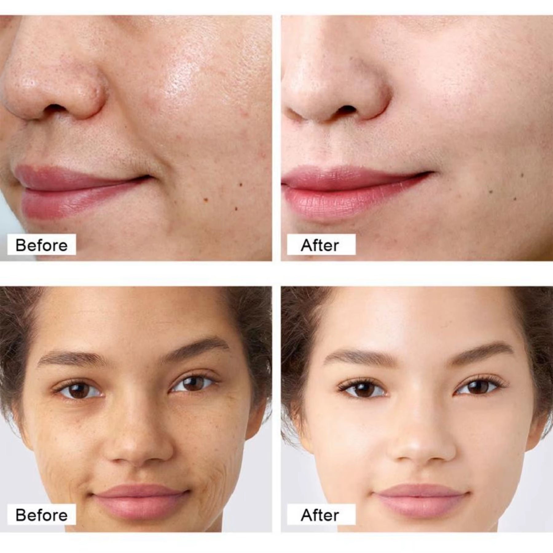 Face Serum Hyaluronic Acid Essence Moisturizing Nursing Snail Nourish Repair Skin Care Korean Beauty Health Whitening Cream