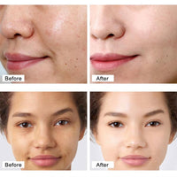 Face Serum Hyaluronic Acid Essence Moisturizing Nursing Snail Nourish Repair Skin Care Korean Beauty Health Whitening Cream