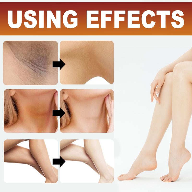 Dark Spot Corrector Cream, Hydrating Repair Dark Joints Black Whitening Brightening Body Cream